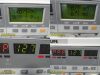 PHILIPS Series 50XM M1350B Maternal ,W/Transducers,Leads,Cart~ Fetal Monitor
