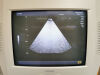 TOSHIBA PSM-25AT Ultrasound Transducer