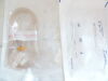 ICU MEDICAL B4121 / 300" 9.0ml Extension Set - Removable 3-Way Stopcock , Checkvalve (2025/08) LOT of 9 (#E1)