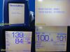 HILL-ROM W. Allyn 45ME0 LXI Spot Vitals Monitor, Masimo SpO2 W/ Leads,NEW BATTERY