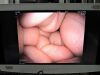 PENTAX EB-1570K Bronchoscope