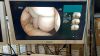 FUJI Gastroscope  EG-L580NW7 Gastroscope