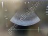 TOSHIBA Xario200( TUS-X200S) Ultrasound - Shared Service
