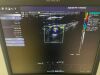 SIEMENS Acuson S2000 Ultrasound - Shared Service