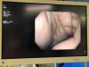 OLYMPUS GIF-H190 Gastroscope
