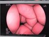 FUJINON EC-530DL Colonoscope