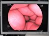 FUJINON EG-450WR5 Gastroscope