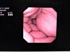 OLYMPUS GIF-160 Gastroscope