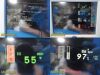 SPACELABS 91370 Ultraview SL Monitor Masimo SpO2 Leads & Module