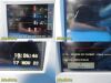 SPACELABS 91370 Ultraview SL Monitor Masimo SpO2 Leads & Module