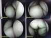 STRYKER 4mmx30°   Video Arthroscope Ref 502-427-030 Rigid Telescope