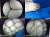 STRYKER 4mmx30°   Video Arthroscope Ref 502-427-030 Rigid Telescope