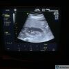 GE 4C-A Convex Ultrasound Probe for Voluson 730