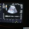 GE 4C-A Convex Ultrasound Probe for Voluson 730