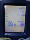 WELCH ALLYN 2015 Philips 8105AS Intellivue MP5SC SpO2 Check Monitor