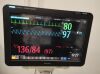 PHILIPS MEDICAL MX800 Monitor