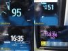 PHILIPS 2015  Spot Check , Intellivue MP5SC /8105AS W/ Patient Leads~ Monitor