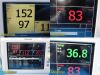PHILIPS 2009  Sure Signs VS3 Ref 863070, W/ Leads (NBP,Temp)~  Patient Monitor