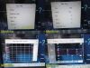 PHILIPS 2015  M8015AS Spot Check Monitor, Intellivue MP5SC W/ Leads