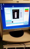 DMS Envision Bone Densitometer