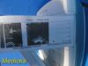 VERATHON BVI9400 Bladderscan Console W/ Probe & Li-Battery (No Charger)