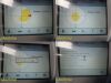 VERATHON BVI9400 Bladder Scanner Console ONLY