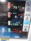 SPACELABS Ultraview SL91369 Patient Monitor