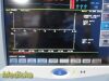 SPACELABS Ultraview SL91369 Patient Monitor