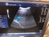 GE 4C Ultrasound Transducer