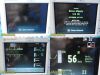 GE DATEX-OHMEDA S-5/FOFM-00 Patient Monitor