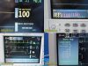 GE DATEX-OHMEDA S-5/FOFM-00 Patient Monitor