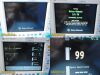 GE DATEX-OHMEDA S5/FM Patient Monitor