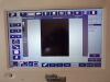 BARD ACCESS SYSTEMS Bard SiteRite Vision 9770032 Vascular Ultrasound System w/ 9770033 Probe & Stand Ultrasound