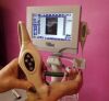 BARD ACCESS SYSTEMS Bard SiteRite Vision 9770032 Vascular Ultrasound System w/ 9770033 Probe & Stand Ultrasound