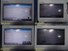 WELCH ALLYN VSM6000 Series Vitals Monitor