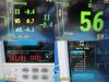 GE DATEX-OHMEDA S5/FM Patient Monitor