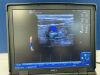 GE Loqiq e R.9 portable ultrasound MSK - Musculoskeletal