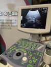 ALOKA Prosound 6 Ultrasound - OB / GYN