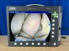 KARL STORZ Telepack X TP100 with camera head and light cable Laparoscope