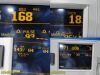 GE HEALTHCARE GE Corometrics 120 Series, New Transducers & Leads ~ Maternal Fetal Fetal Monitor