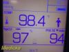 WELCH ALLYN 45NT0 Spot Vital Signs  LXI W/ New Leads, 4500-922 Radio & PSU