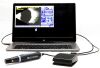 ACCUTOME Pro B-Scan