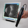 SONOMED Master VU B-Scan