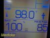 WELCH ALLYN W. Allyn 45NT0 Spot Vital Signs LXI Monitor Suretemp Plus,Nellcor Oximax