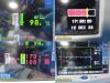 SPACELABS 91367 Ultraview SL Patient Monitor