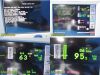 SPACELABS 91367 Ultraview SL SW V2.03.14, Command Module 90496,Leads & PSU~30558 Module
