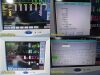 SPACELABS 91367 Ultraview SL SW V2.03.14, Command Module 90496,Leads & PSU~30558 Module