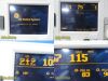 GE HEALTHCARE GE 120 Series Mod 0128 Maternal Fetal Monitor