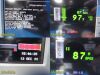 SPACELABS 91367 Ultraview SL, 91496 Command Module, PSU, New Leads~ Monitor