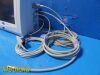 SPACELABS Ultraview SL 91367 Vitals Monitor